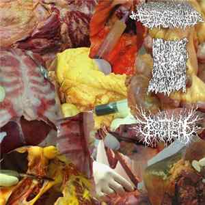 Trabecular Hepatocellular Carcinoma, Ripping Off Your Herpe Scabs With A Power Sander, ROTTENCROTCH - Split Mp3