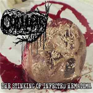 Coagulopathy - The Stinking Of Infected Hematoma Mp3