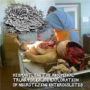 Botched Anastomosis J-Pouch - Dismantling The Abdominal Trunk For Crude Exploration Of Necrotizing Enterocolitis Mp3