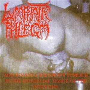 Lymphatic Phlegm / Flesh Grinder - Malignant Cancerous Tumour In The Epithelial Tissue Of The Intestine / From Rotten Process... To Splatter Mp3
