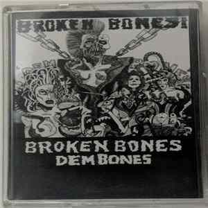 Broken Bones! - Dem Bones Mp3
