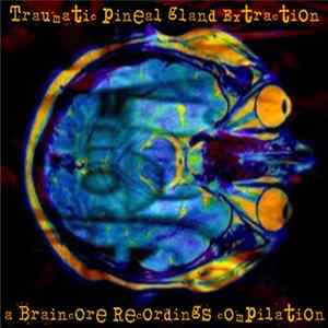Various - Traumatic Pineal Gland Extraction Mp3