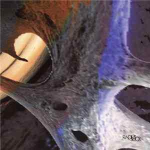 Various - Radius Suck Mp3