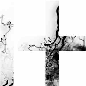 Black Arcade - Transhuman Mp3