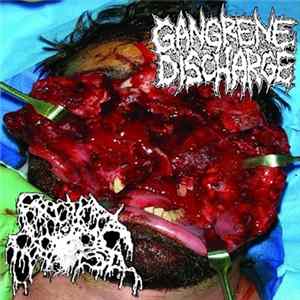 Gangrene Discharge / Rectal Prolapse - Split Mp3